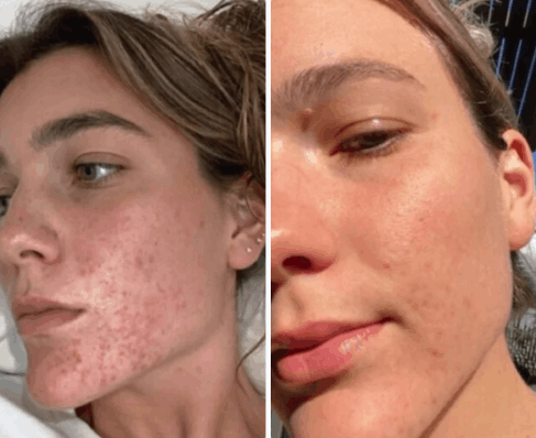 Parasite Cleanse customer–Sophie D. 26 y.o.. Washington, USA