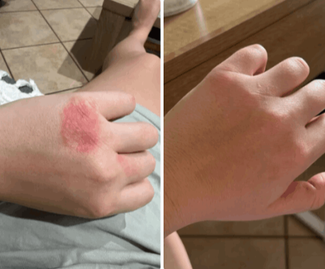 Parasite Cleanse customer - Megan M. 34 y.o. Texas, USA